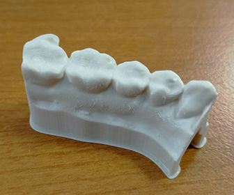 Modelo dental en resina biocompatible LCD